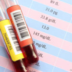 血液検査で糸球体ろ過量（eGFR）が低い！原因と改善方法は？