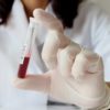 血液検査で赤血球の数が多い時の原因は？病気の可能性と対策方法