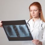 胸部レントゲン(胸部X線)で見つかる「肺の白い影」からわかる病気